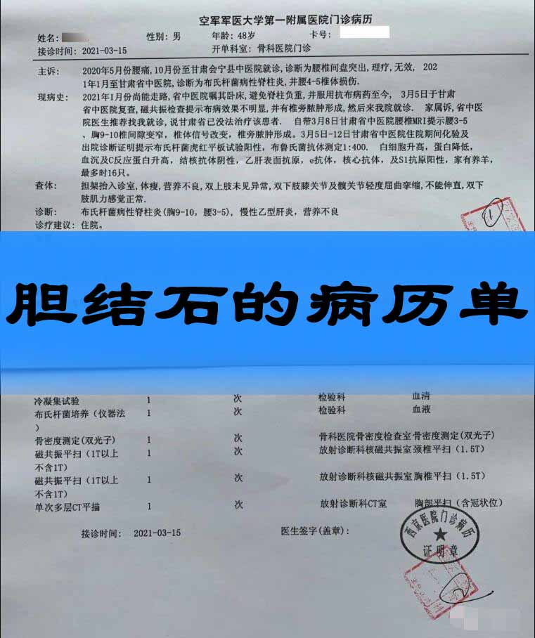 胆结石病历单怎么开