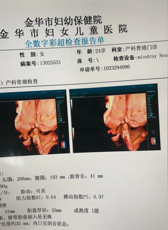 金华医院怀孕证明图片高清