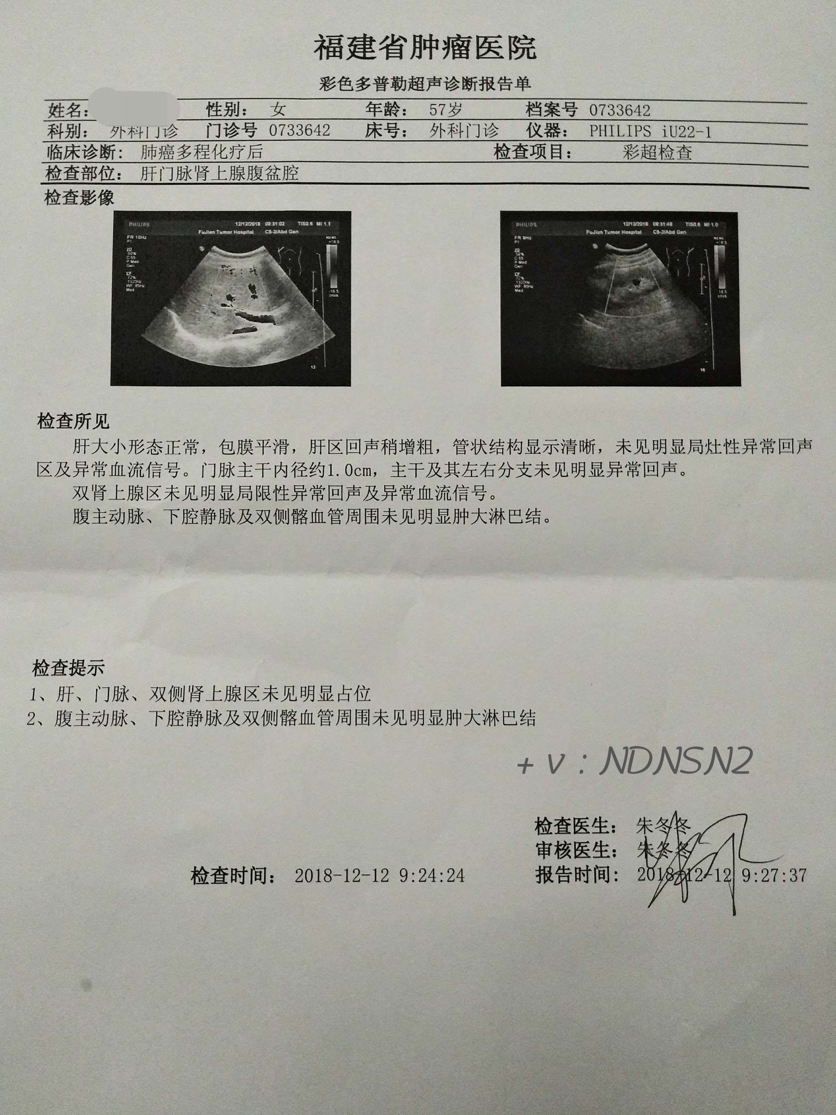 癌症超声报告单