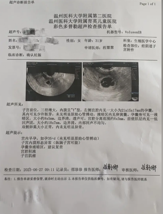 温州超声报告单